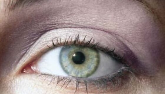 auge