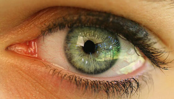 auge