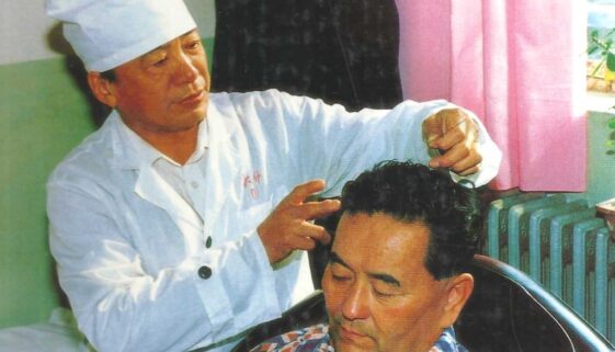 Jiao-Shun-fa, Schädelakupunktur