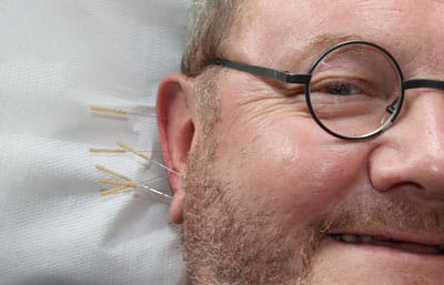 Aurikulomedizin und RACTestung