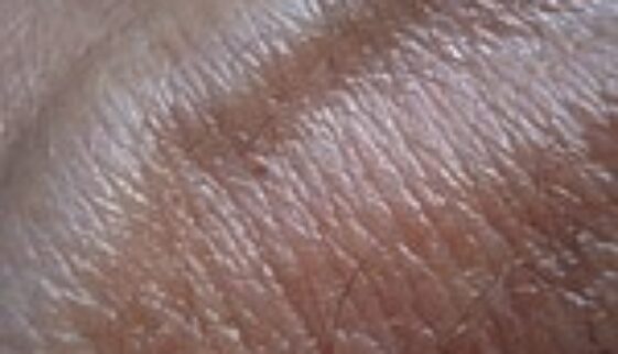 Haut