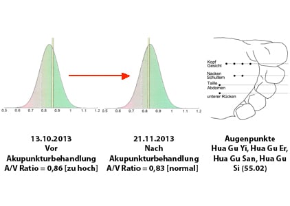 schaubild_ross_tung