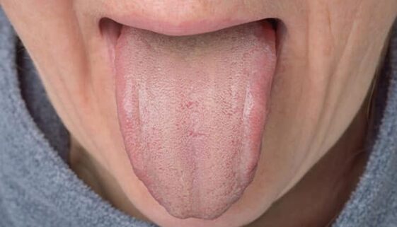 Zugendiagnose_Blog