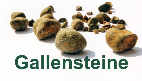 Gallensteine_1000x664