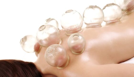 cupping massage - a young woman