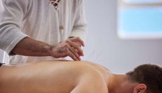 Ive never felt more relaxed. Shot of a acupuncturist treating a client