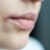 Lippenherpes: Schützen Schüßler Salze?