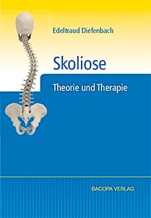 Skoliose